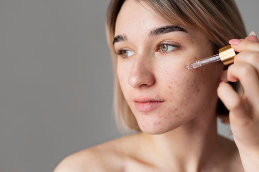 Tired of Dark Spots? Meet Your New Skincare Dream Team: Vitamin C, Niacinamide & Bakuchiol!