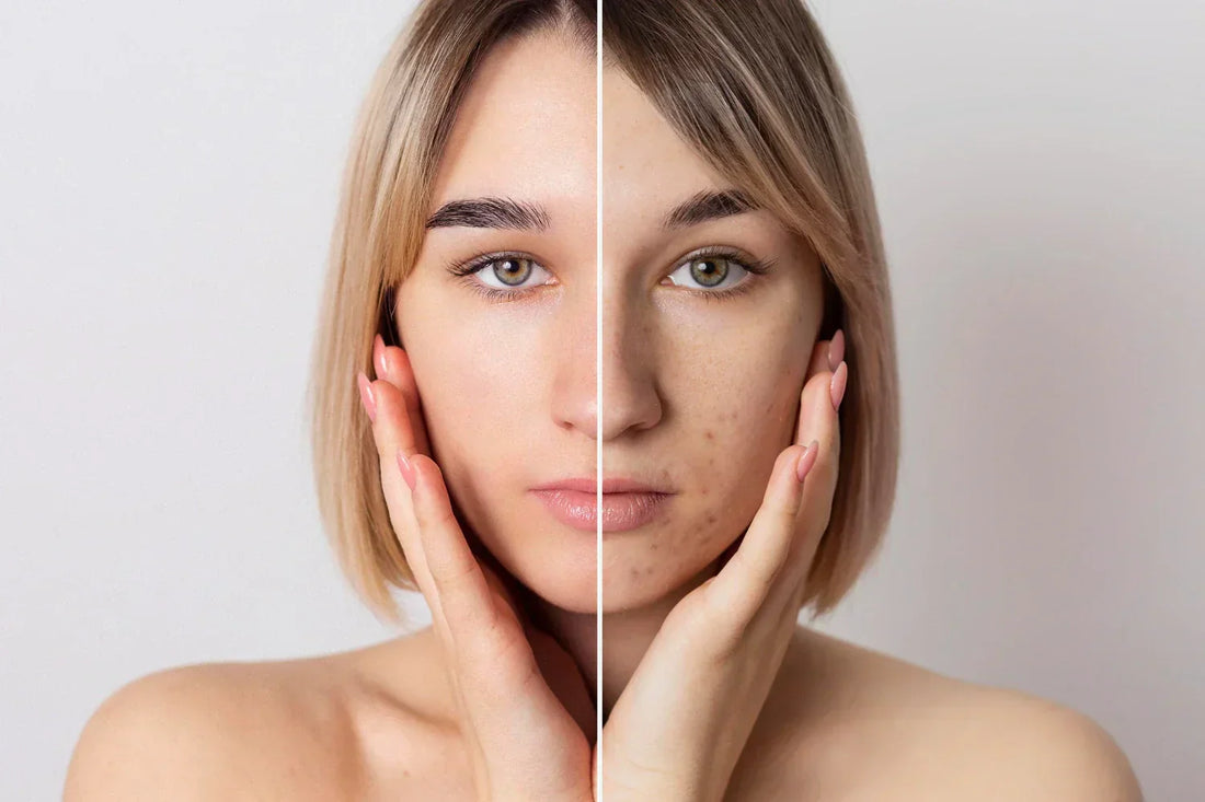 Does Vitamin C Help with Dark Spots