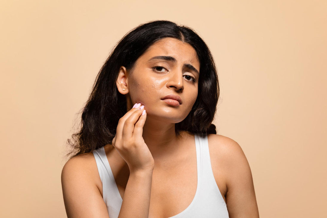 Vitamin C Serum for Oily, Acne-Prone Skin: Benefits and Tips