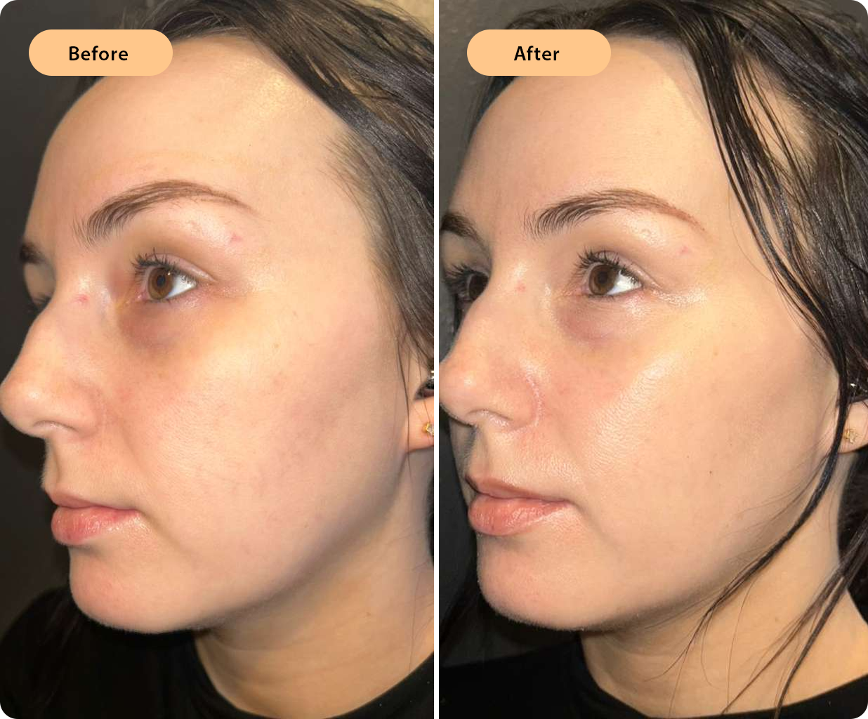 Banana Pudding Glow Mask