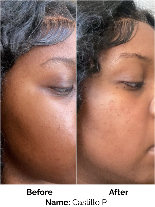 Customer result