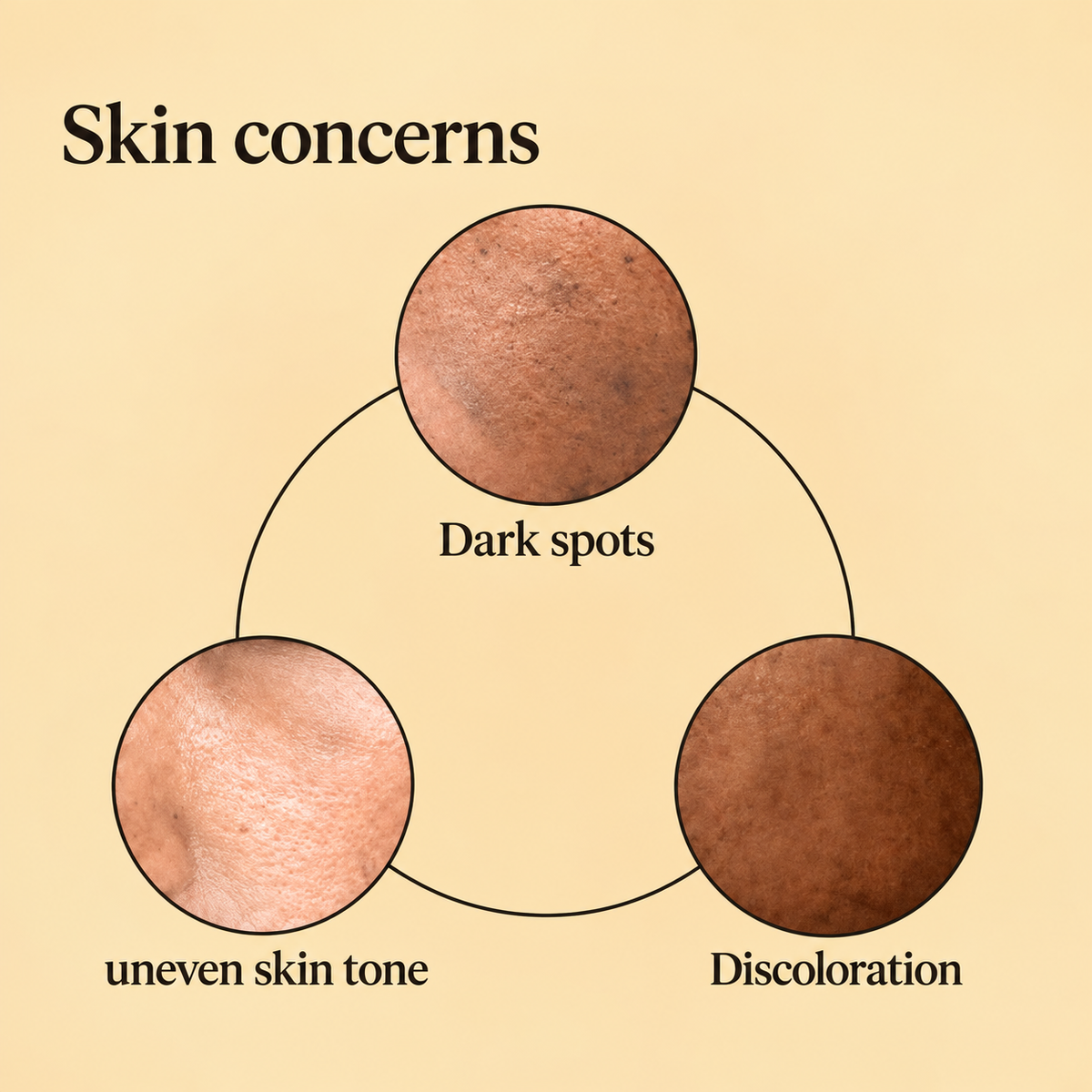 Hyper C Dark Spot Serum