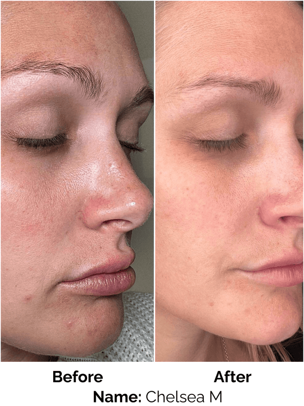 Customer result