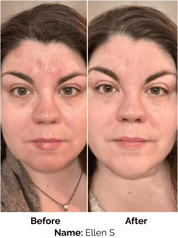 Customer result