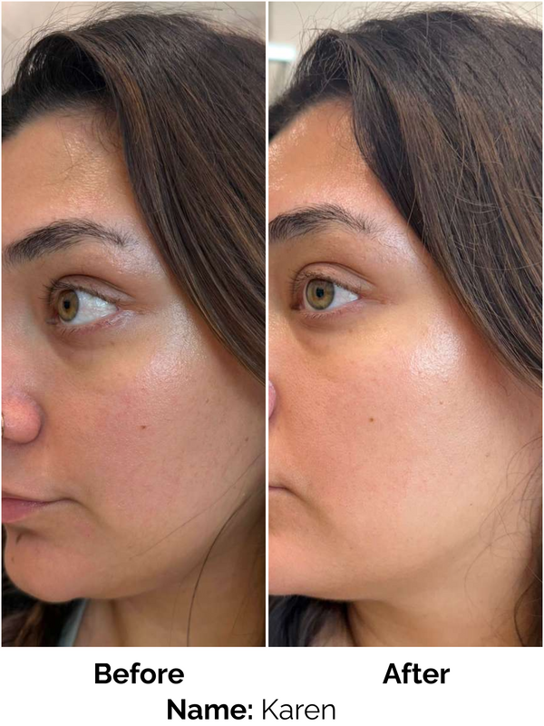 Customer result