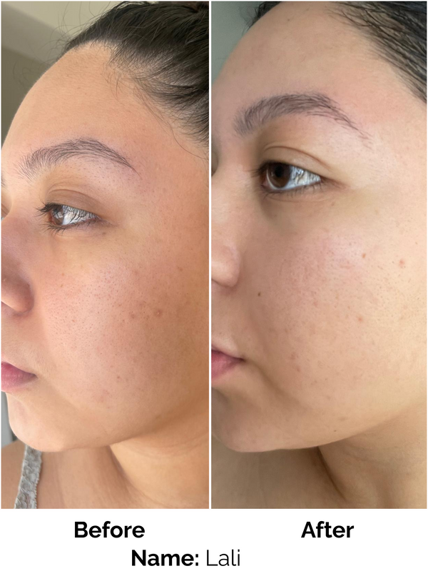 Customer result