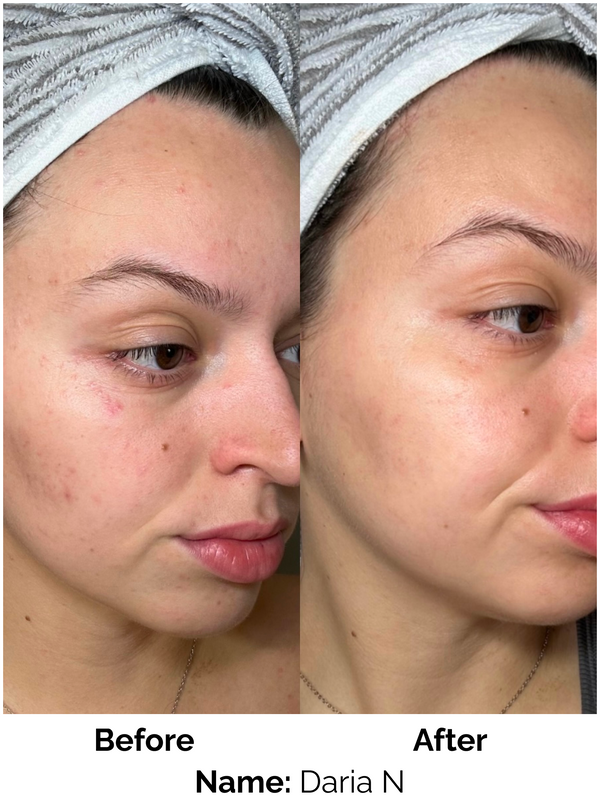 Customer result