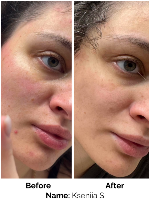Customer result
